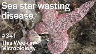 TWiM 341: Sea star wasting disease