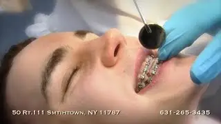 Dr Craig Smith Orthodontics Promo