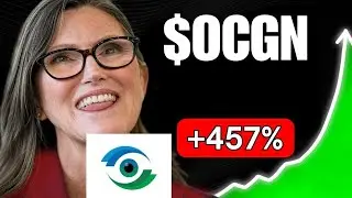 OCGN Stock WEDNESDAY NEWS! (the exact answer) Ocugen stock ic markets review broker