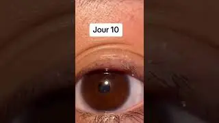 R&eacute;animation de mes cils en 30 jours 😍✨