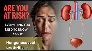 Nongonococcal urethritis Explained Causes, Symptoms and Treatment, All Insights