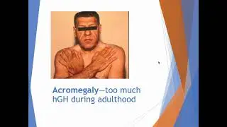 SEXTON BIOL 2402 LAB ENDOCRINE DISORDERS