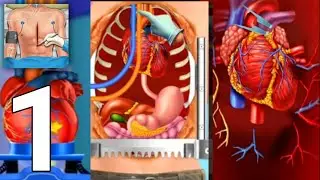 Open Heart Surgery New Games: Offline Doctor Games    Gameplay Walkthrough Part 1   Android