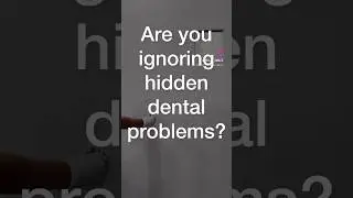 Hidden Dental Problems? OPG Scans Reveal the Truth | Expert Diagnosis at Dollar Smiles 🦷