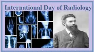 International Radiology Day 8 Nov || Important Days and Dates With Theme of 2023