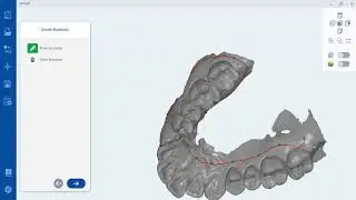 RAYDENT Designer_study model