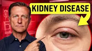 18 Warning Signs of Kidney Damage You Can See on Your Body