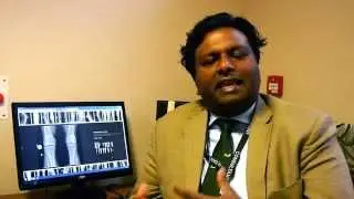 Knee Replacement Surgery Sam Rajaratnam
