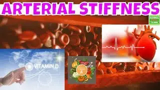 Arterial  Stiffness ,Naturally Reduce Your Risk of Arterial Stiffness with Vitamin D and K