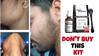 Don&rsquo;t Buy Man Matters Beard Kit Before Watching This | Man Matters Beard Growth Kit Review |