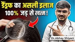 Dandruff (रूसी/डैंड्रफ) का असली इलाज | How to Remove Dandruff Permanently? | Sun Homoeopathy