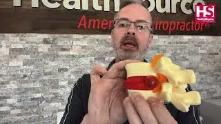 Understanding Disc Injuries | Chiropractor for Low Back Pain in Huntsville, AL