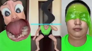CRAZIEST Sagawa1gou Funny TikTok Compilation | Try Not To Laugh Watching Cactus Dance Challenge 2025