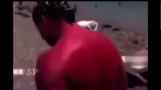 Sunburned Guy Gets Slapped On Back