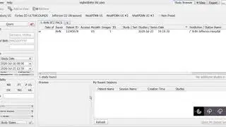 How to make a work list on Visage