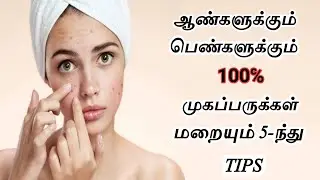 100% முகப்பருக்கள் மறையும் TIPS|HOW TO REMOVE PIMPLES IN TAMIL|PIMPLES REMOVAL ON FACE AT HOME