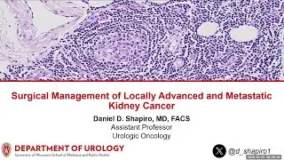 UW Urology Grand Rounds: Surgery for Locally Advanced and Metastatic Kidney Cancer 1/7/2026