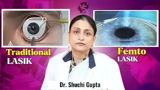 Why is FemtoSecond (Bladeless) LASIK better than traditional LASIK? |  Dr. Shuchi Gupta