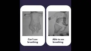 Instant Peace of Mind with Breathing Reassurance Convertible Baby PJ's
