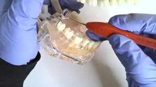 How to use Furcation Diamond File LM&trade; hand instrument
