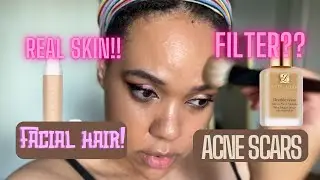 REAL SKIN NO FILTER // ACNE SCARS, HAIR, DARK SPOTS // WHAT FOUNDATION LOOKS LIKE UP CLOSE