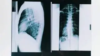 The Doctor (short film)