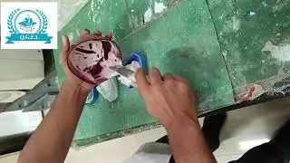 How Make Base in the cast with the help of Base Former.#dentistry #dentist #dental 