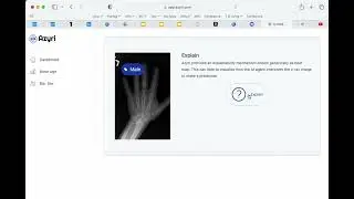 Mary, the #artificialintelligence assistant, guessing sex from x-ray image. No human can do it!