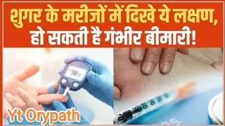 #suger #शुगर टेस्ट क्या होता है #rbs #fbs #ppbs #viralvideo #best knowledge full video