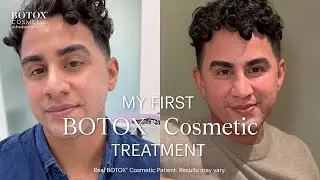 First Time Getting BOTOX&reg; Cosmetic: Jeffrey Opens Up About the Experience