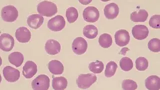 Howell Jolly Bodies