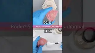 Rodin Soft Reline vs Traditional Relines #3dprinteddentures #dentalartistry #dentist