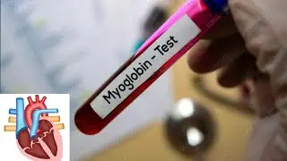Myoglobin blood test: introduction: Normal range: purpose: Procedure: High and Low causes