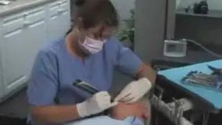 KaVo Diagnodent Pen: Laser Fluorescence Caries Detection