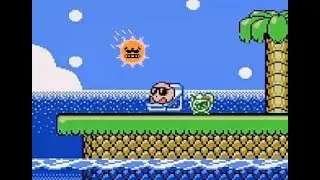 Bum in the Sun | Kirby's Adventure Episode 2