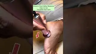 Effortless foot care with electric callus remover! #beauty #footcallusremover