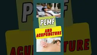 Pemf and Acupuncture