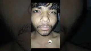 Natural beard growth 11 week journey 📈📈#man matters #minoxidil