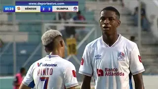 Julian Martinez vs Genesis | Liga Nacional 2024