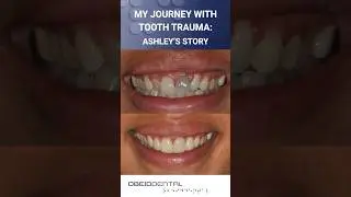 My Journey with Tooth Trauma: Ashley's Story