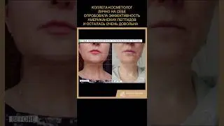 Отзыв коллеги-косметолога на американские пептиды - попробовала на себе #cosmetology #peptides