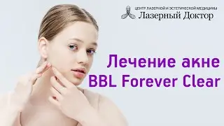 Лечение акне. BBL Forever Clear.