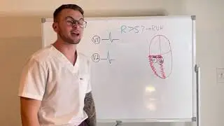 EKG Series: Right Ventricular Hypertrophy Criteria