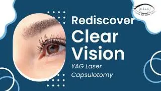 Rediscover Clear Vision with Sussex YAG Eye Laser Capsulotomy