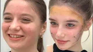 drastically beautifying and reconstructing your face until you reach your full potential 💉🎀