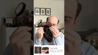 Lavivid Tyler Hair System Review After 3 Months- Part 2