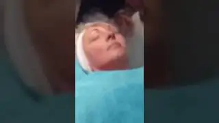 Cryotherapy NI | Frotox | Facial | Facelift