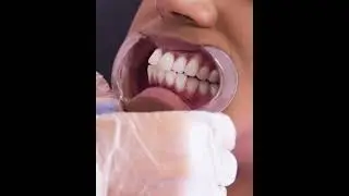 PHOTO READY SMILE