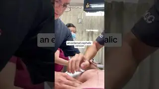 🤯🤯Flipping a Breech Baby TODAY‼️