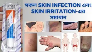 Pevisone Cream বাংলায় সম্পূর্ণ মেডিসিনের বিবরণ । Med Unlimited